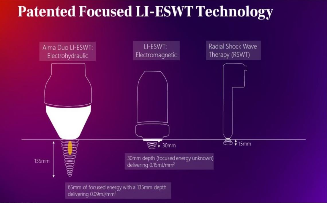 patented focus